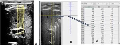 Liver tissue changes during and post 6-month spaceflight as measured by ultrasound radio frequency signal processing